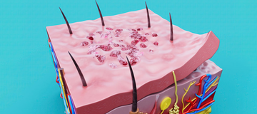 Tissue Repair & Recovery